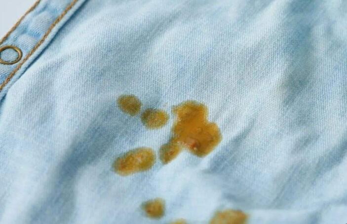 衣服上沾了油渍怎么去除  食用油弄衣服上用什么能洗能洗掉